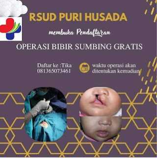 Gratis, RSUD PH Tembilahan Buka Pendaftaran Oprasi Bibir Sumbing
