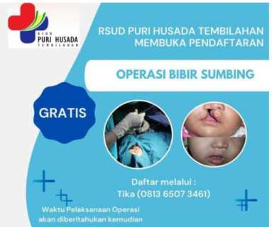 RSUD PH Tembilahan Akan Tampung Pasien Operasi Bibir Sumbing